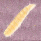 Maggot Therapy